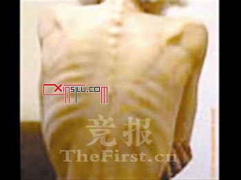 �������ܳ���֮��&nbsp;����ʳ֢������